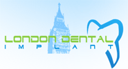 Feedback from London Dental Implant